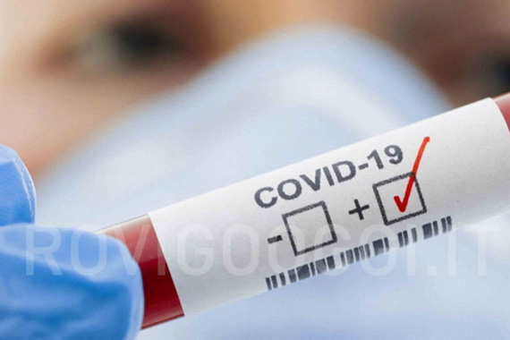 coronavirus,pandemia,tamponi,attualmente positivi